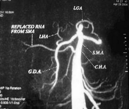 Descrizione: C:\Users\antonio.morselli\Documents\_JOP\ARCHIVIO\2010\201001\13_fig01.jpg