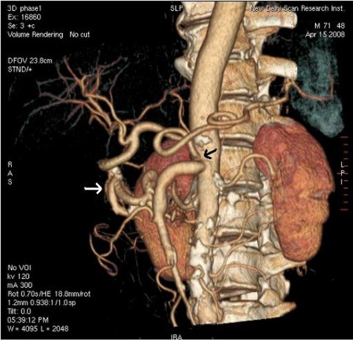 Descrizione: C:\Users\antonio.morselli\Documents\_JOP\ARCHIVIO\2010\201001\13_fig03.jpg