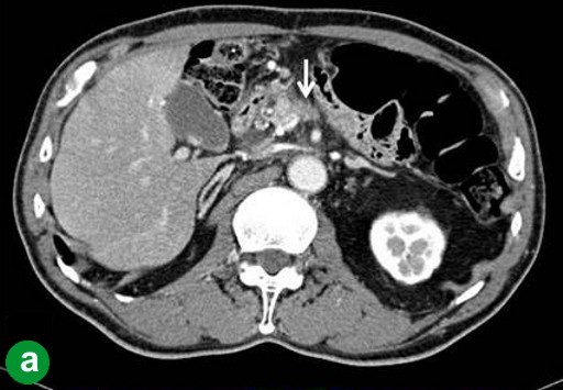 Descrizione: C:\Users\antonio.morselli\Documents\_JOP\ARCHIVIO\2010\201001\02_fig04a.jpg