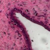 Pancreatic ductal epithelium showing vacuolated neuroendocrine cells