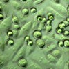 MiaPaCa2 cells treated with 25 μM chloroquine for 24 hours (Figure 1e)