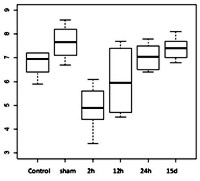 Boxplot of LVEDD