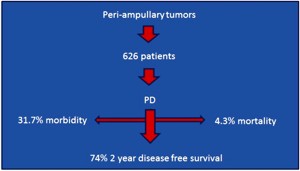 Morbidity, mortality, and survival of patients with peri-ampullary tumors who underwent pancreaticoduodenectomy