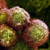 Pancreatic cancer cells (Anne Weston, LRI, CRUK, Wellcome Images)