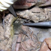 Downward course of the splenic vein