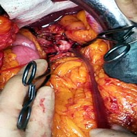 Intraoperative snapshot