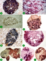 Multi-labeling of normal pancreatic islets