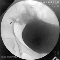 Fluoroscopic control