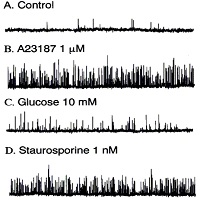 Inhibitory effects of glucose on KCa channels