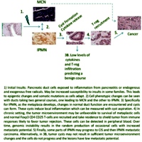 Hypothetical progression of IPMN to adenocarcinoma