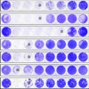 Multiwell plates containing pancreatic cancer cells stained with crystal violet showing Ulster Newcastle disease virus cytotoxicity
